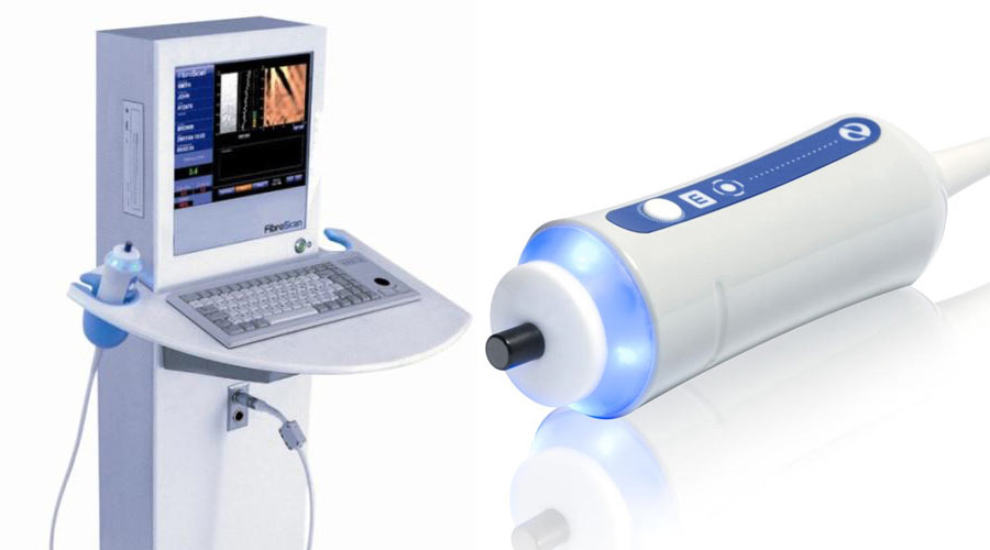 FibroScan